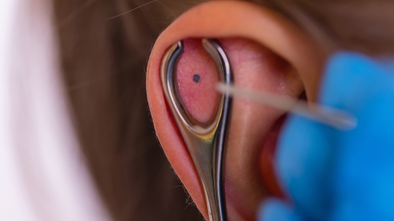 Needle piercing cartilage