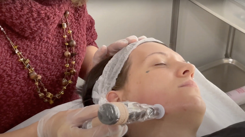 woman getting procell microchanneling 