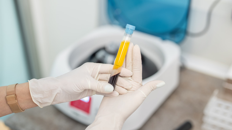 Gloved hands holding blood sample
