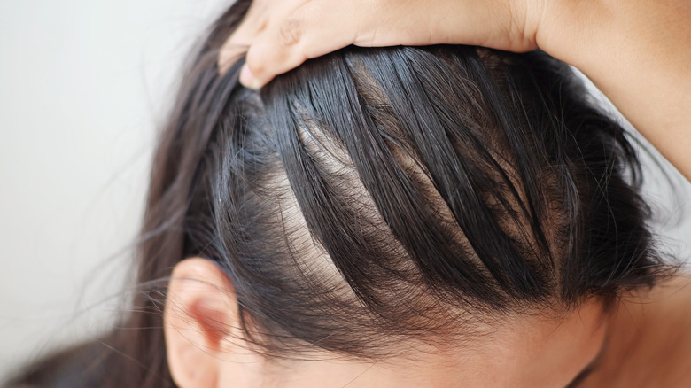woman with thinning hair