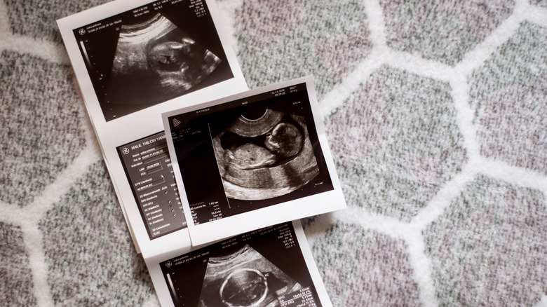 layered ultrasound pictures