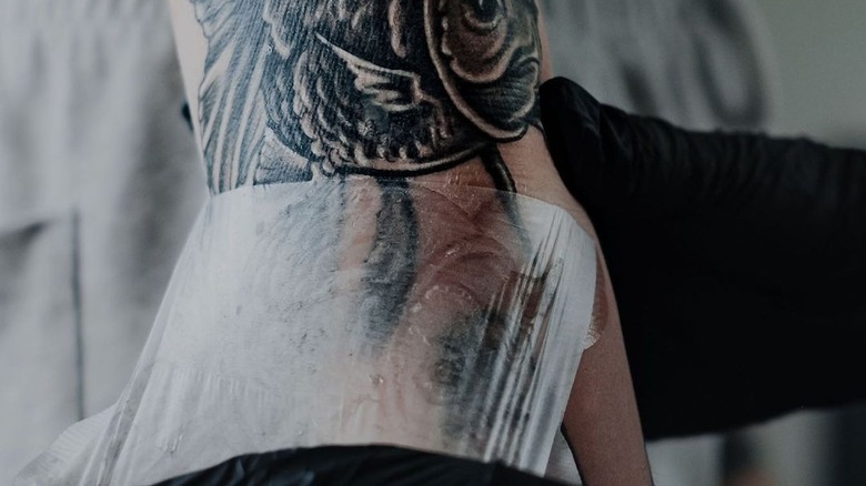 peeling off Saniderm patch