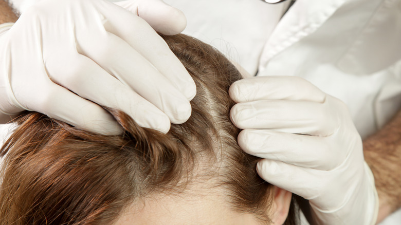SMP technician examines woman's scalp