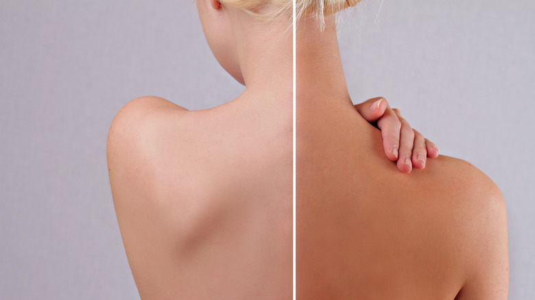 woman tanned and untanned