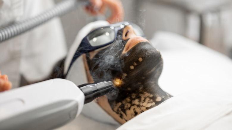 A woman getting a carbon laser facial
