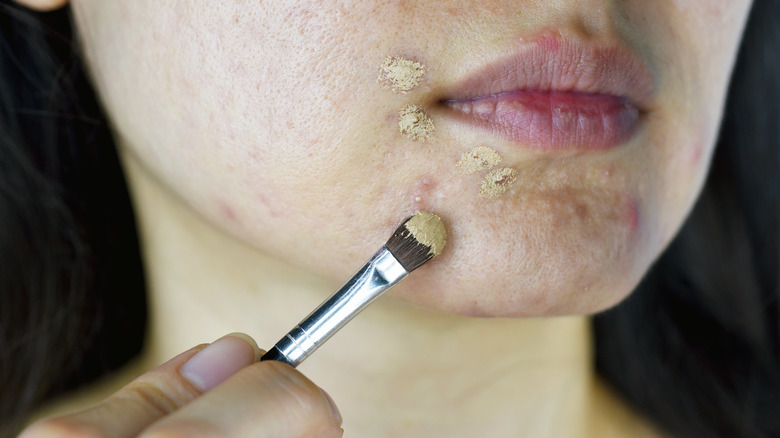 woman applying concealer on acne