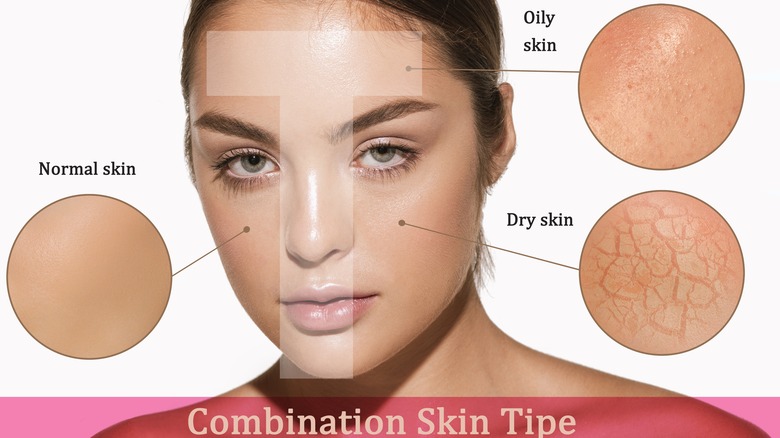 different skin types