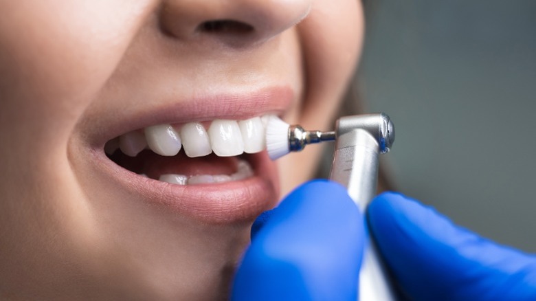 Woman getting professional teeth cleaning
