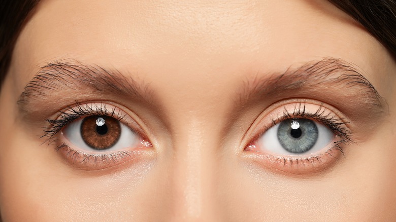 heterochromatic eyes