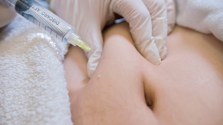 Derma filling injection