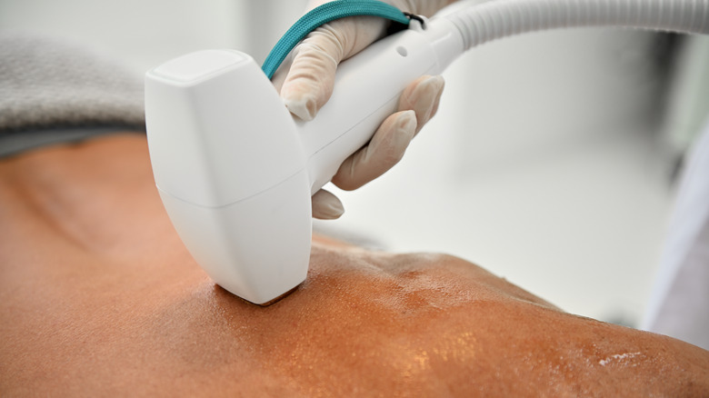 Radio wave treatment on back