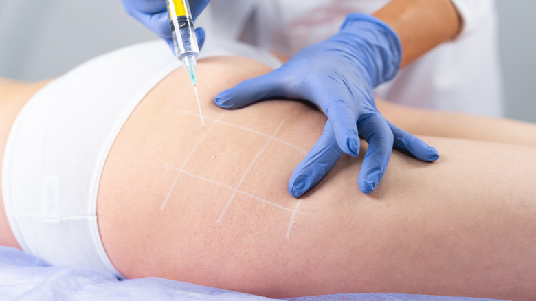 Dr. giving skin injection