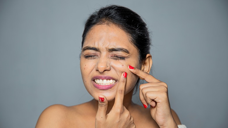 Woman upset with face blemishes