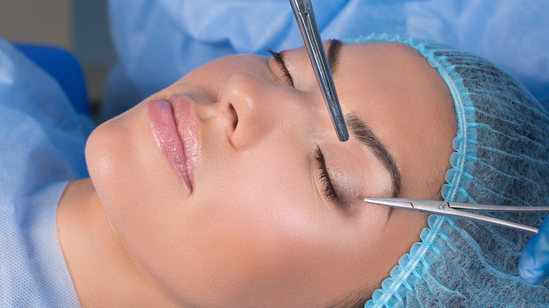 woman blepharoplasty