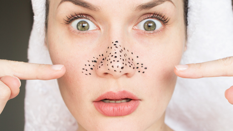 Woman with large pores on her nose