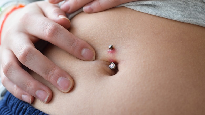 infected belly button piercing