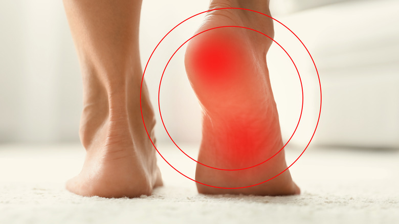 Pain points on a foot. 