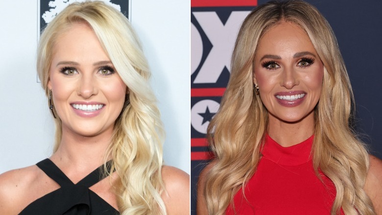 Tomi Lahren with natural brows versus overdrawn brows