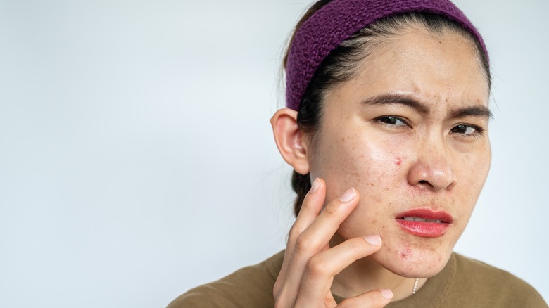 Woman looking at acne on face