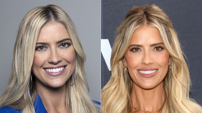 Christina Haack's before and after photos showing she hass continued to maintain volume and smoothness in her mid face