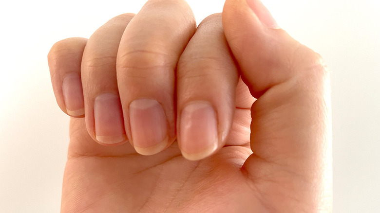 ridges on nails after serum