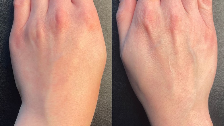 Close up image of hands after using Omnilux