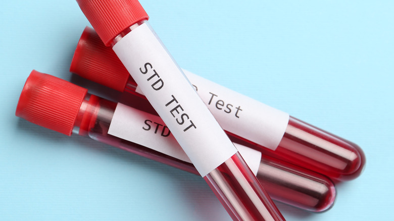 STD test vials