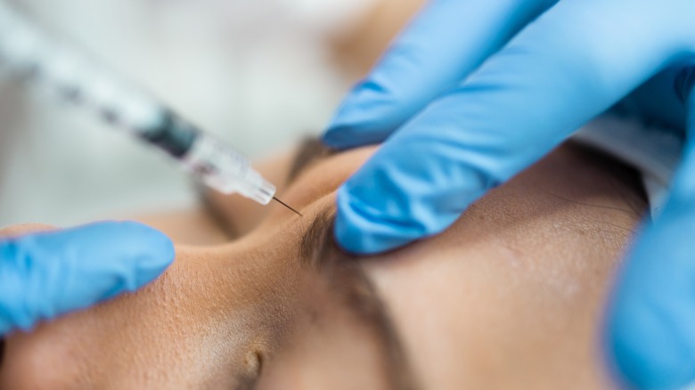 Close up of syringe entering patient's glabella