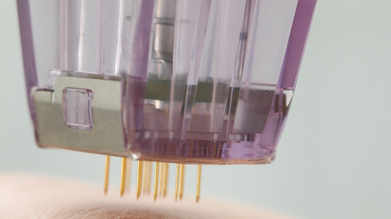 microneedling device close up