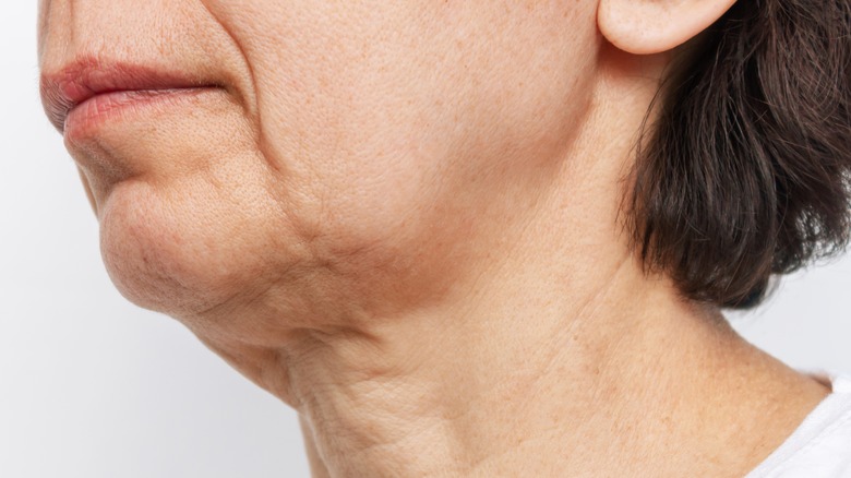 woman saggy chin
