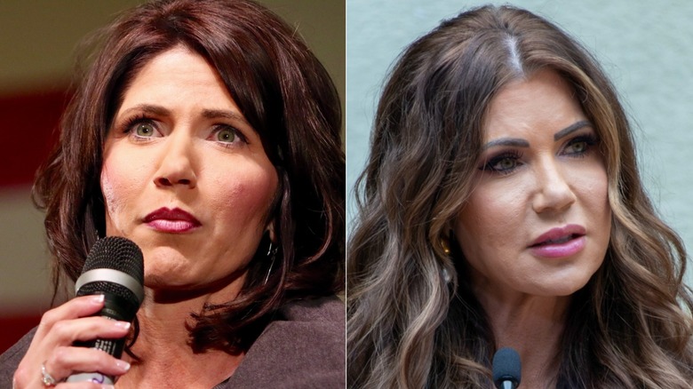 Kristi Noem before vs after lip fillers