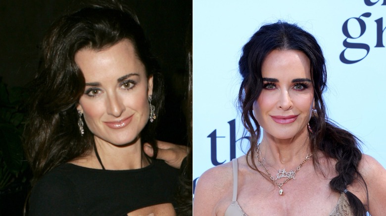 Kyle Richards with wavy black hair before and after her nose job