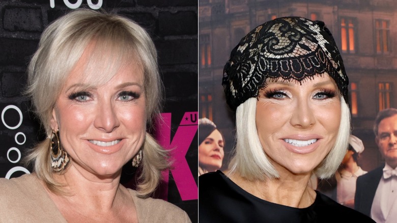 Margaret Josephs from RHONJ before and after her facelift