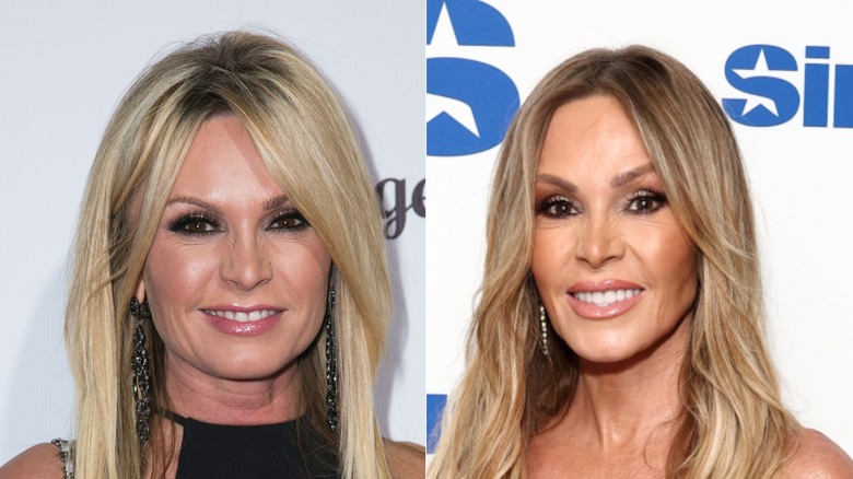 Tamra Judge before and after her facelift