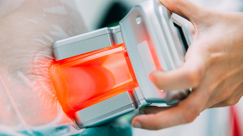 close up of coolsculpting in action