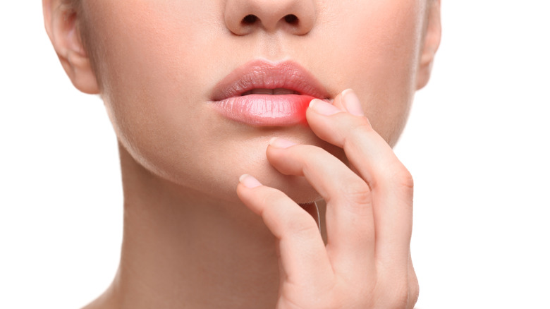 woman touching sore lip