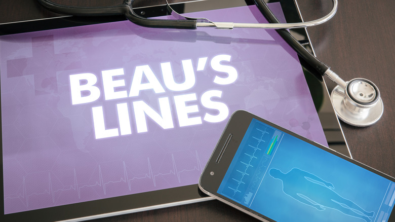 Beau's lines written on tablet