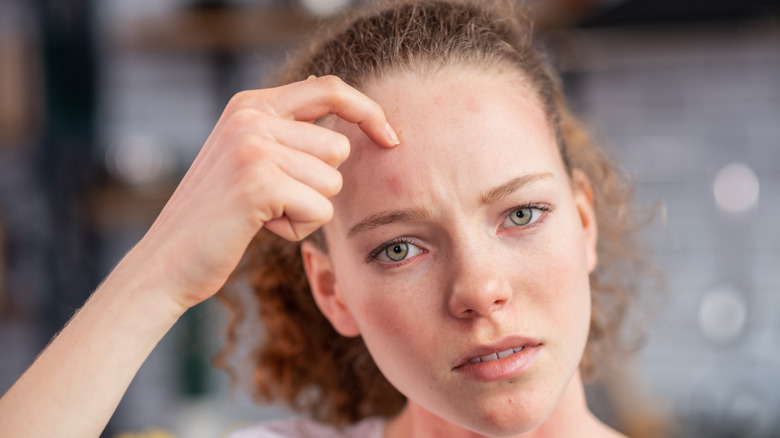 woman with rash on forehead