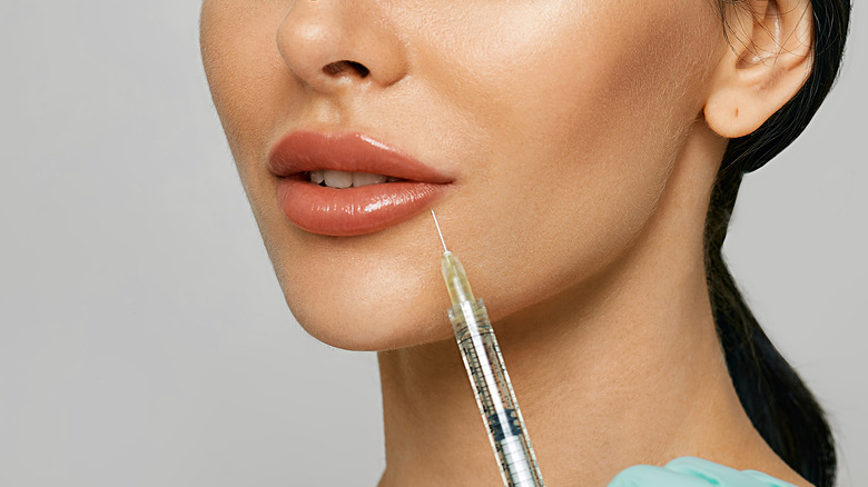 female dermal filler lips