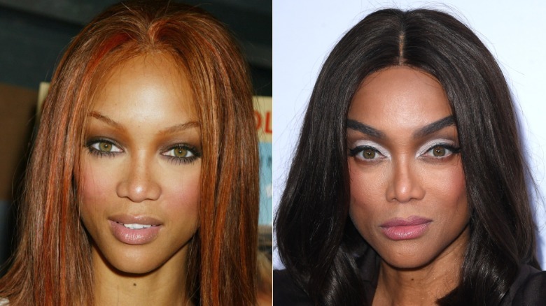 Tyra Banks before and after plastic surgery