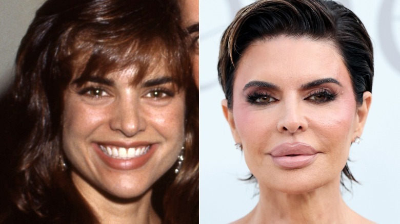 Lisa Rinna looking very different before and after plastic surgery