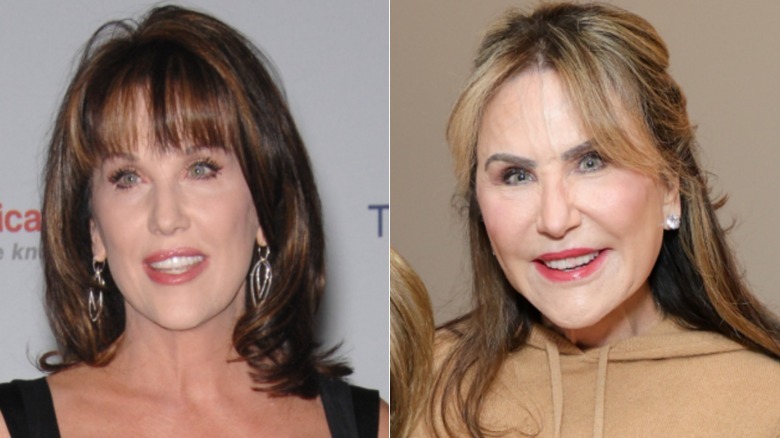 Dr. Phil's Wife Robin's face before and after her Mar-A-Lago face transformation