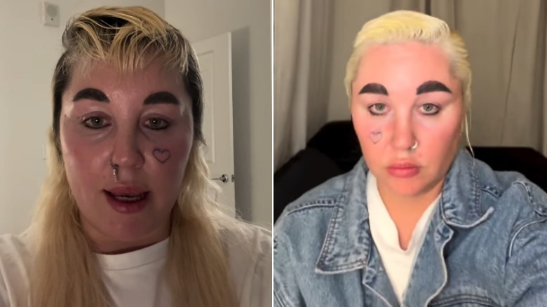 Side-by-side photos showing Amanda Bynes' weight loss