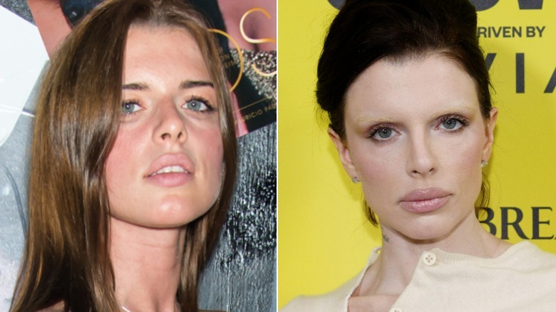 Before and after photos showing Julia Fox's plastic surgery