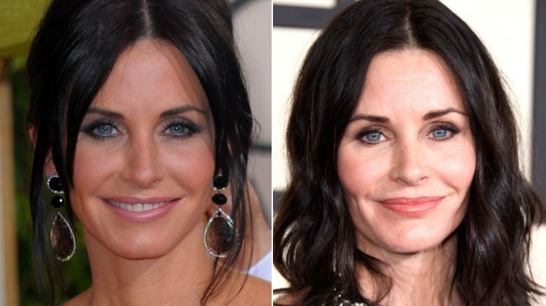 Side-by-side photos showing Courteney Cox's face with and without fillers